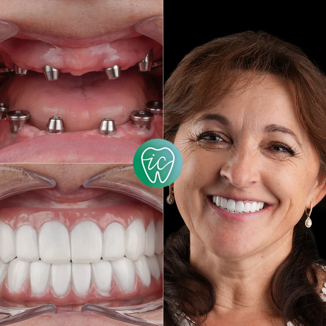 Treatment before and after